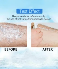 (🔥Hot Summer Sale - 50% OFF)2021 Magical Hair Inhibitor & Hair Removal💝BUY 1 GET 1 FREE!!