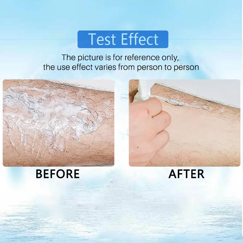 (🔥Hot Summer Sale - 50% OFF)2021 Magical Hair Inhibitor & Hair Removal💝BUY 1 GET 1 FREE!!