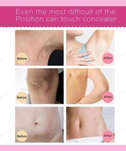 ❤️SPRING DAY FLASH SALE - 50% OFF-- VOVA™ 2021 NEW WHITENING CREAM