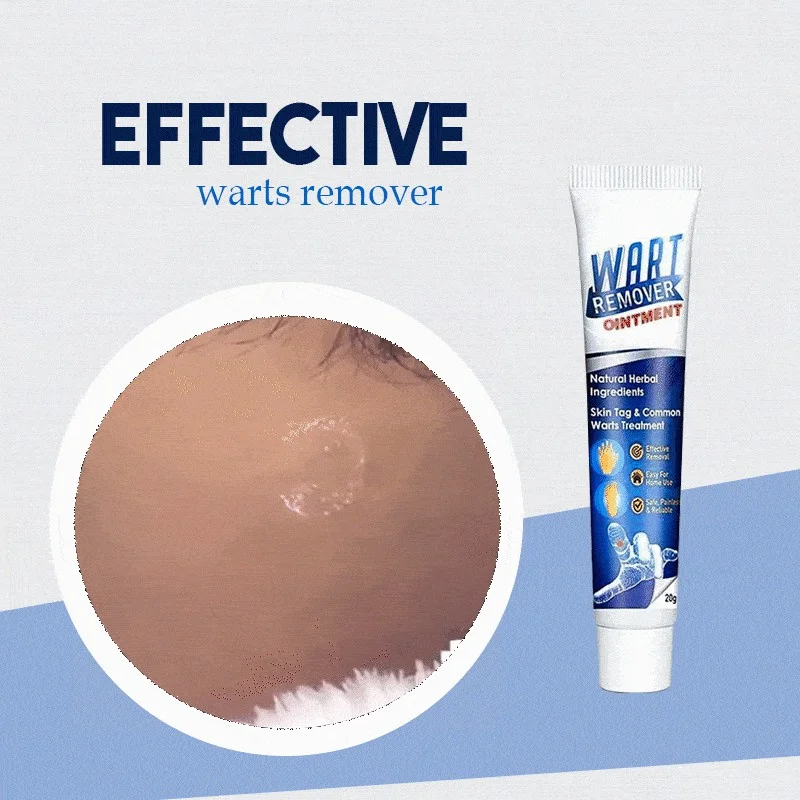 (🔥Hot Summer Sale - 50% OFF)SkinTag Instant Remover Cream💝BUY 1 GET 1 FREE!!