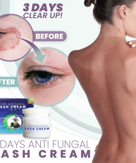 3 Days Anti Fungal Rash Cream