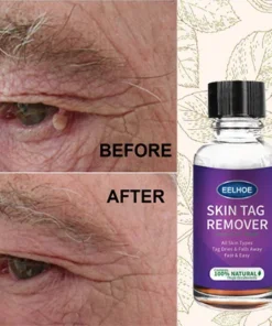 [SUMMER HOT SALE] Instant freckle removing essence