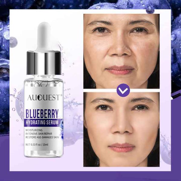 🔥Buy 1 Get 1 Free--AUQUEST™ 2021 Bagong Blueberry Instant Wrinkle Essence