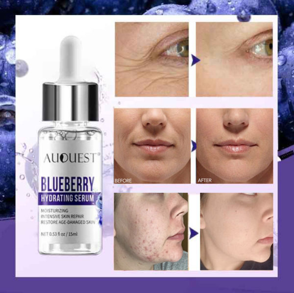 🔥Buy 1 Get 1 Free--AUQUEST™ 2021 Bagong Blueberry Instant Wrinkle Essence