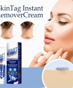 (🔥Hot Summer Sale - 50% OFF)SkinTag Instant Remover Cream💝BUY 1 GET 1 FREE!!