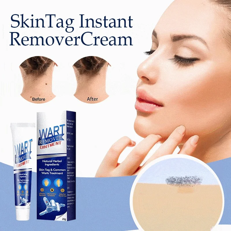 (🔥Hot Summer Sale - 50% OFF)SkinTag Instant Remover Cream💝BUY 1 GET 1 FREE!!