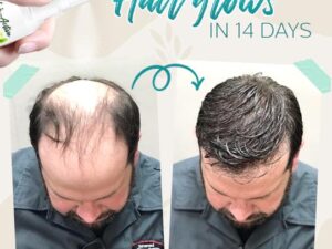 Hair-Active™ Root-Boost Ginger Spray