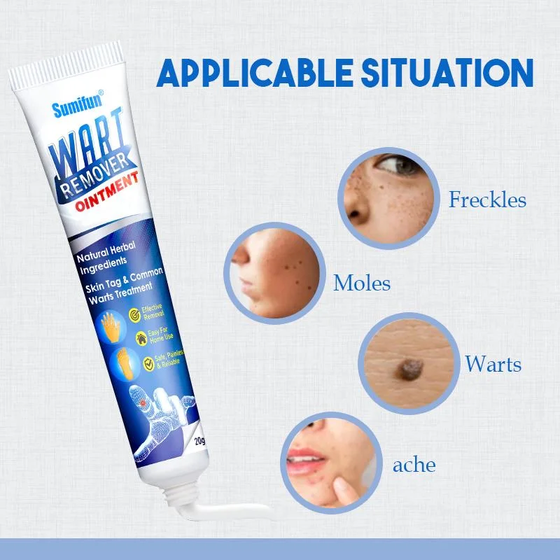 (🔥Hot Summer Sale - 50% OFF)SkinTag Instant Remover Cream💝BUY 1 GET 1 FREE!!