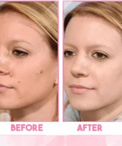 ReFine™ Skin Spot Purifying Essence