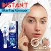 Instant Skin Tag Removal