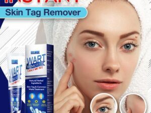 Instant Skin Tag Removal