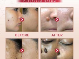 Natural Skin Care Purifying Serum