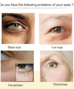 Anti Wrinkles Magic Eye Cream🔥BUY 1 GET 1 FREE🔥