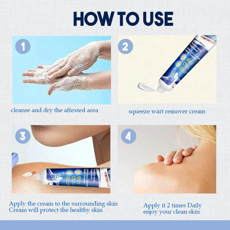 (🔥Hot Summer Sale - 50% OFF)SkinTag Instant Remover Cream💝BUY 1 GET 1 FREE!!