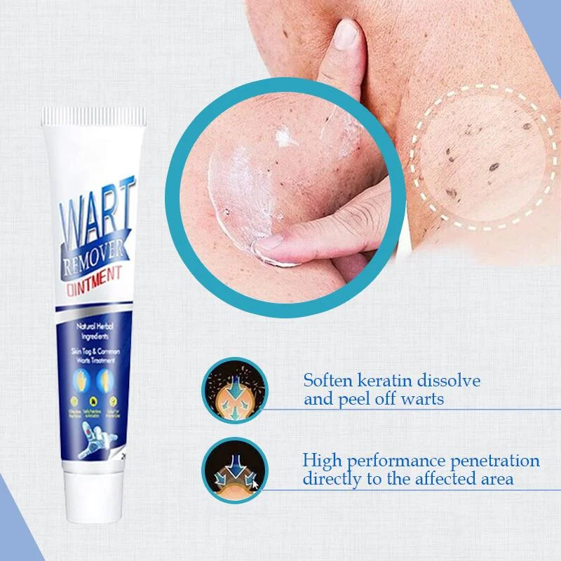 (🔥Hot Summer Sale - 50% OFF)SkinTag Instant Remover Cream💝BUY 1 GET 1 FREE!!