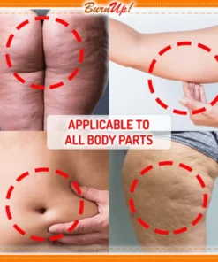 BurnUp! Cellulite Heating Spray