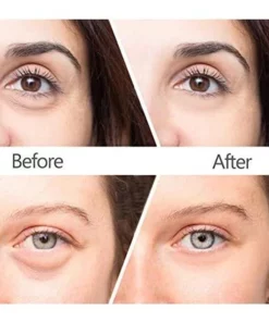 Anti Wrinkles Magic Eye Cream🔥BUY 1 GET 1 FREE🔥