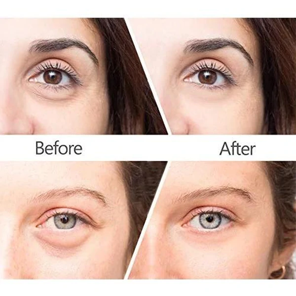 Anti Wrinkles Magic Eye Cream🔥BUY 1 GET 1 FREE🔥