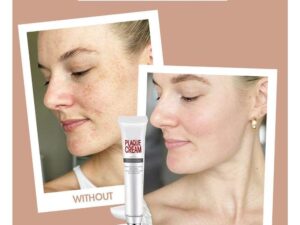 [SUMMER HOT SALE] Repair Fade Freckles Remove Dark Spots Face Cream