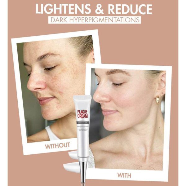 [SUMMER HOT SALE] Repair Fade Freckles Remove Dark Spots Face Cream