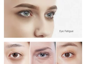 2021 Magic Electric Massager Eye Cream