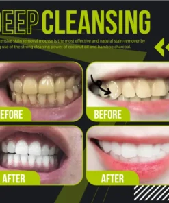 Coconut Oil Tooth Whitening Mousse