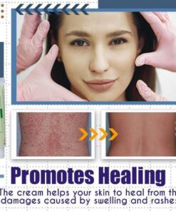 LaCure™ Eczema Calming Cream