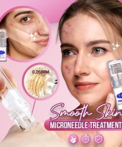 Smooth Skin Microneedle Treatment