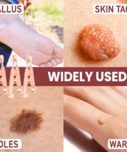 TagsClear™ Copper Set