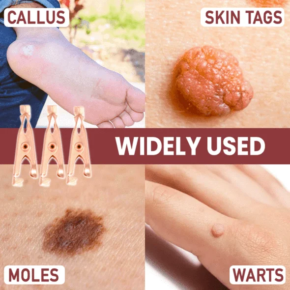 TagsClear™ Copper Set