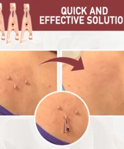 TagsClear™ Copper Set