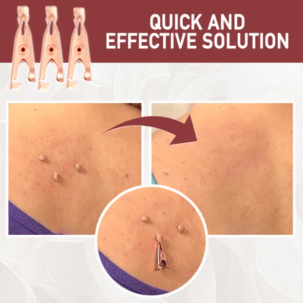 TagsClear™ Copper Set