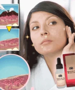 ReFine™ Skin Spot Purifying Essence