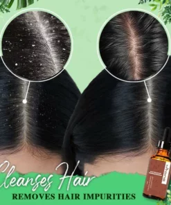 Anti-Dandruff Treatment Essence