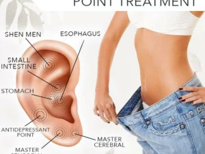 AccuBean™ Magnetic Slimming Ear Patch 600pcs
