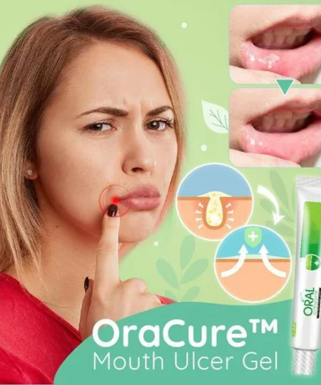 OraCure™ Mouth Ulcer Gel