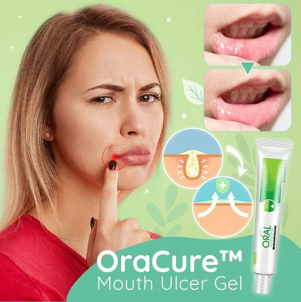 OraCure™ Mond Geschwëster Gel