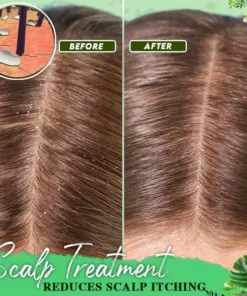 Anti-Dandruff Treatment Essence