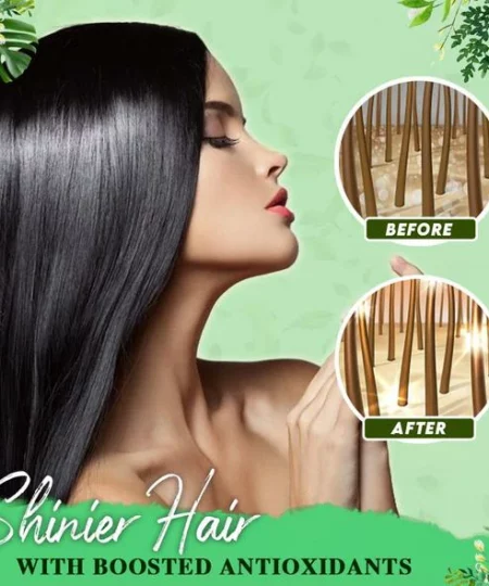 Anti-Dandruff Treatment Essence