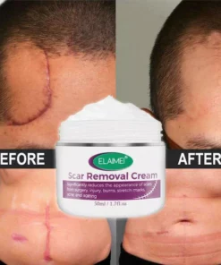 🔥 Organic Skin Rebound Cream