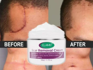 🔥Organic Skin Rebound Cream