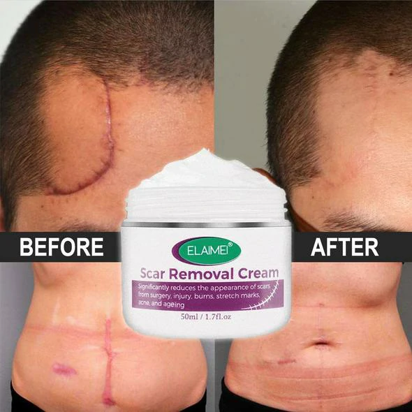 🔥Organic Skin Rebound Cream