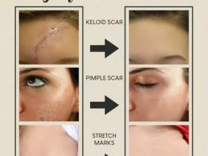 🔥Organic Skin Rebound Cream