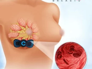 ShakeItUp™ EMS Breast Massage Enhancer