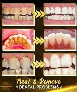 🔥Coconut Oil Tooth Cleansing Mousse