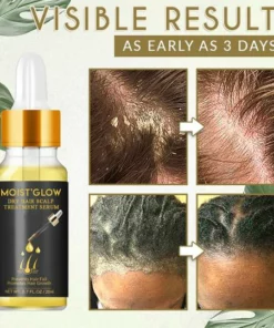 Moist'Glow Dry Scalp Treatment Serum