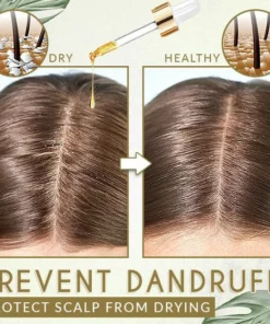 Moist'Glow Dry Scalp Treatment Serum