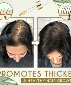 Moist'Glow Dry Scalp Treatment Serum