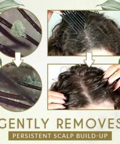 Moist'Glow Dry Scalp Treatment Serum