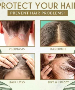 Moist'Glow Dry Scalp Treatment Serum